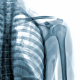 Skeleton X-Ray
